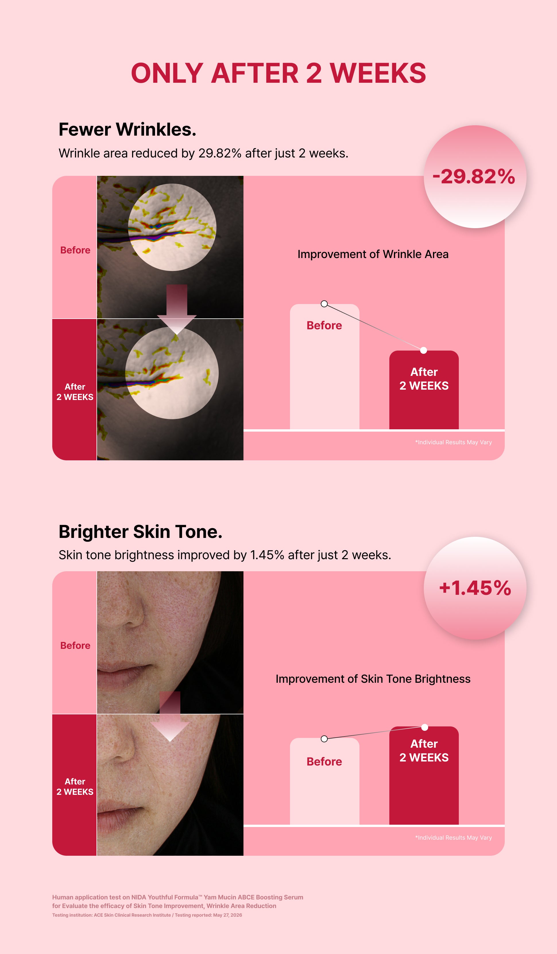 Wrinkle analysis images before and after 2 weeks of use