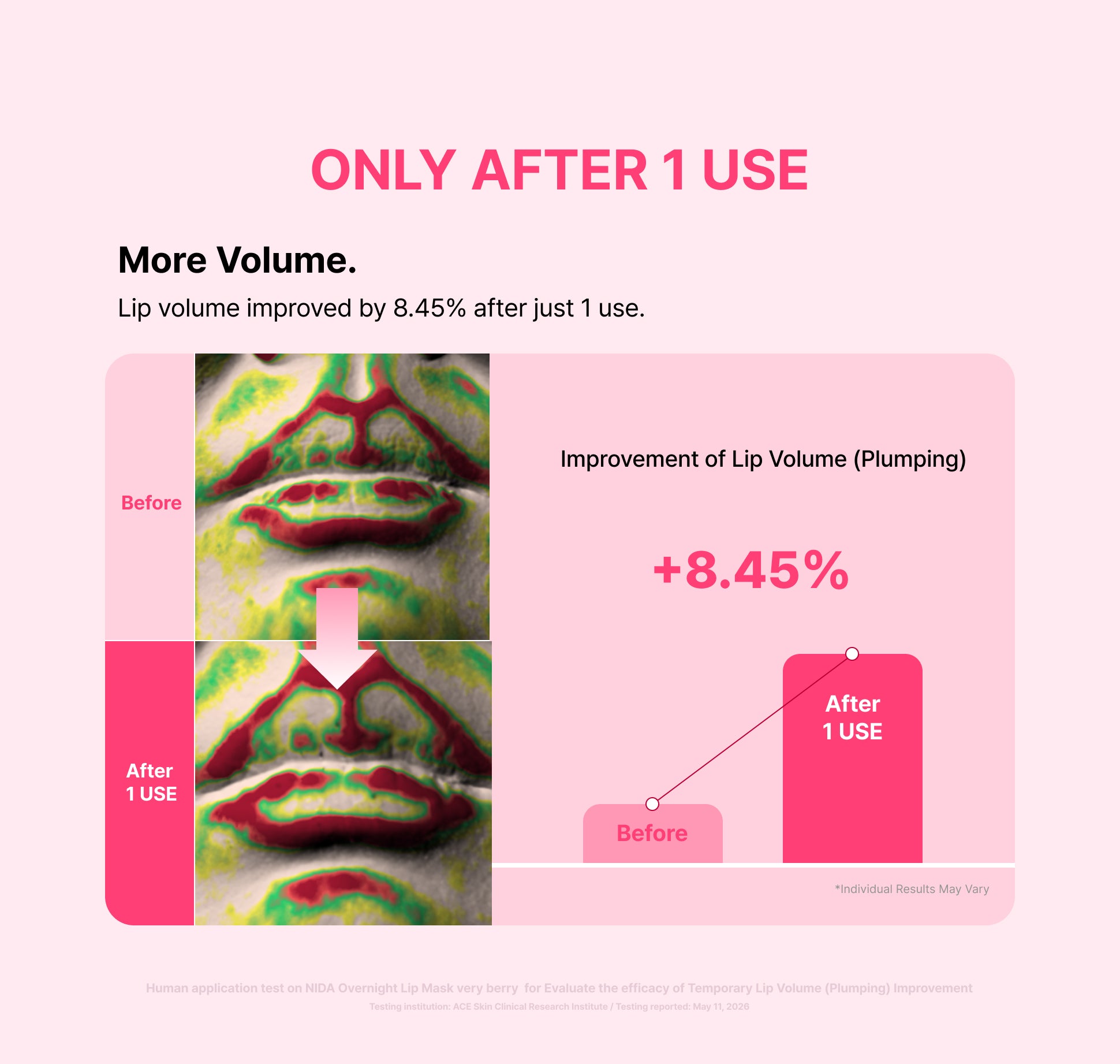 Color-mapped lip volume scans before and after 1 use