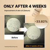 NIDA White Black Exfoliating Serum Duo Bundle