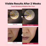 Yam Mucin ABCE Boosting Bundle