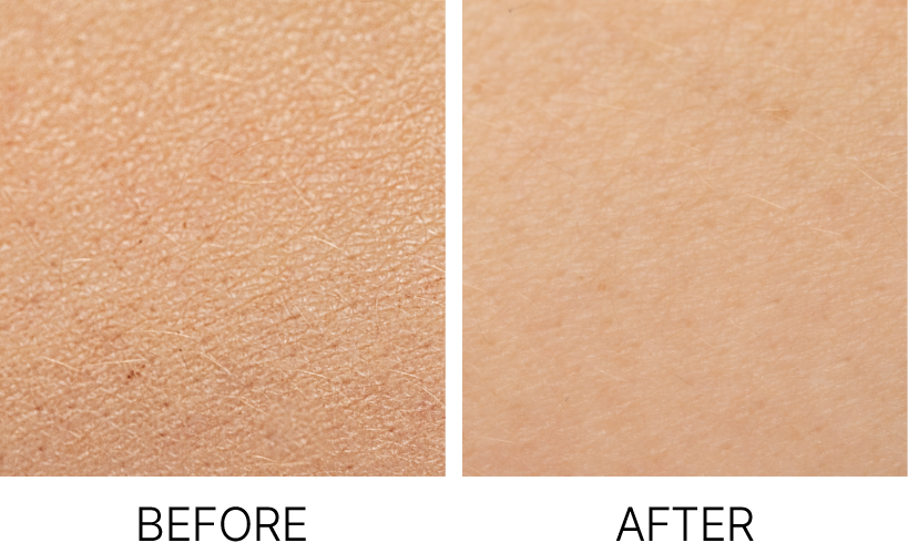 before&after-01.png