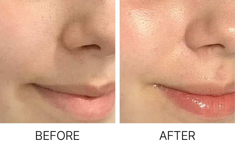 before&after-02.png