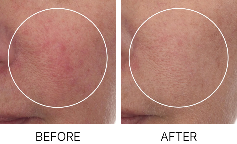 before&after-04.png